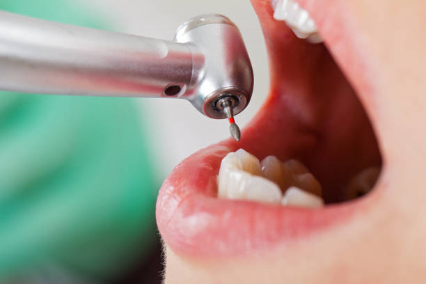 Best Urgent Care for Lost Fillings or Crowns in Conestee, SC